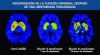 Drogas, sus  efectos y desdentoxicación